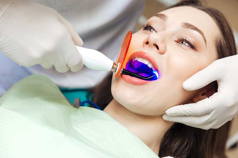 composite fillings dentist