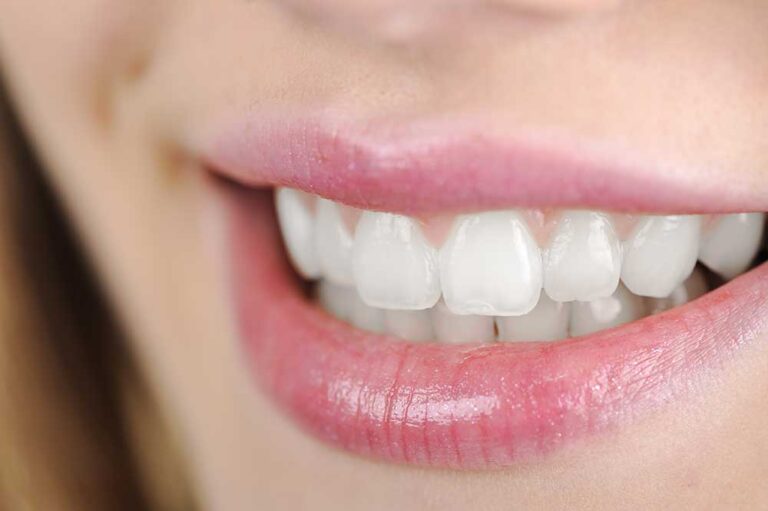 Teeth Whitening Near Me Professional Teeth Whitening Dentist Katy TX